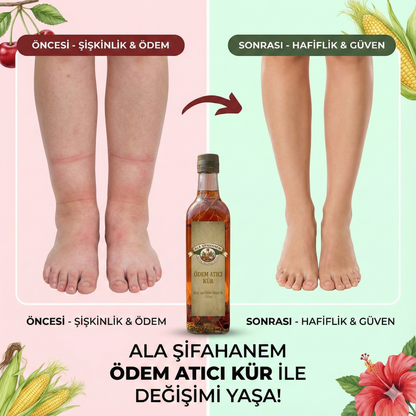 ÖDEM ATICI FERMENTE SİRKE (500 ml)