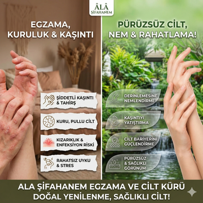 EGZAMA VE CİLT DESTEKLEYİCİ FERMENTE SİRKE (500 ml)